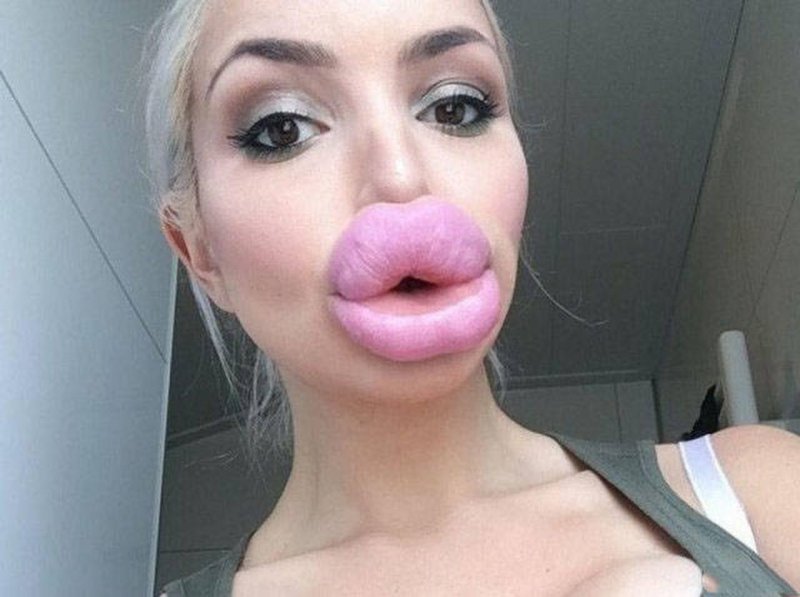 Накаченные губы
