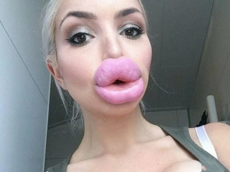 Огромные губы