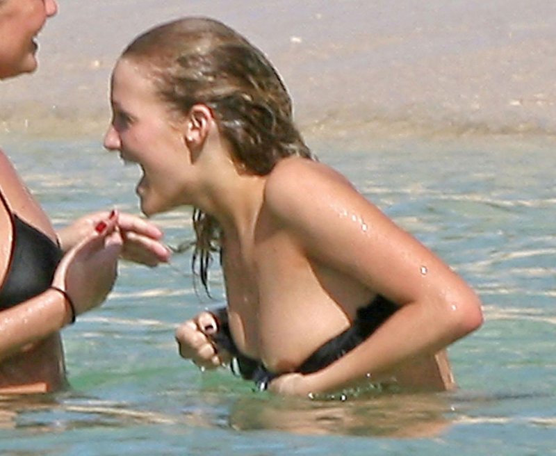 Nipple slip